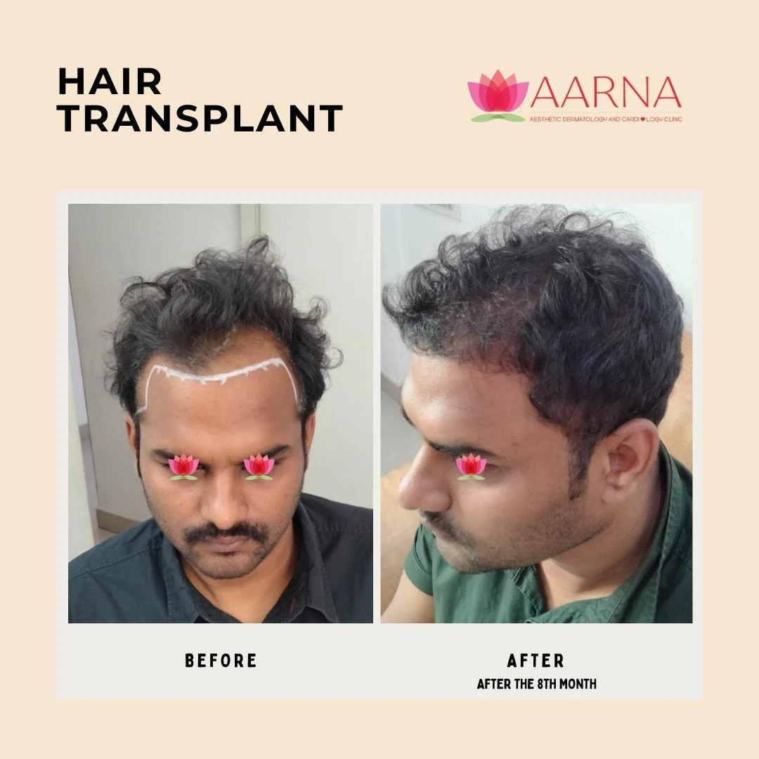 real results