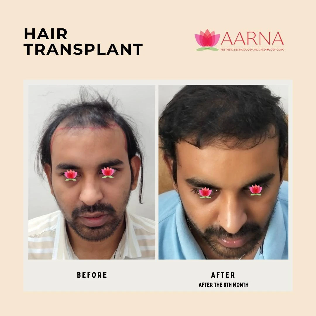 real results